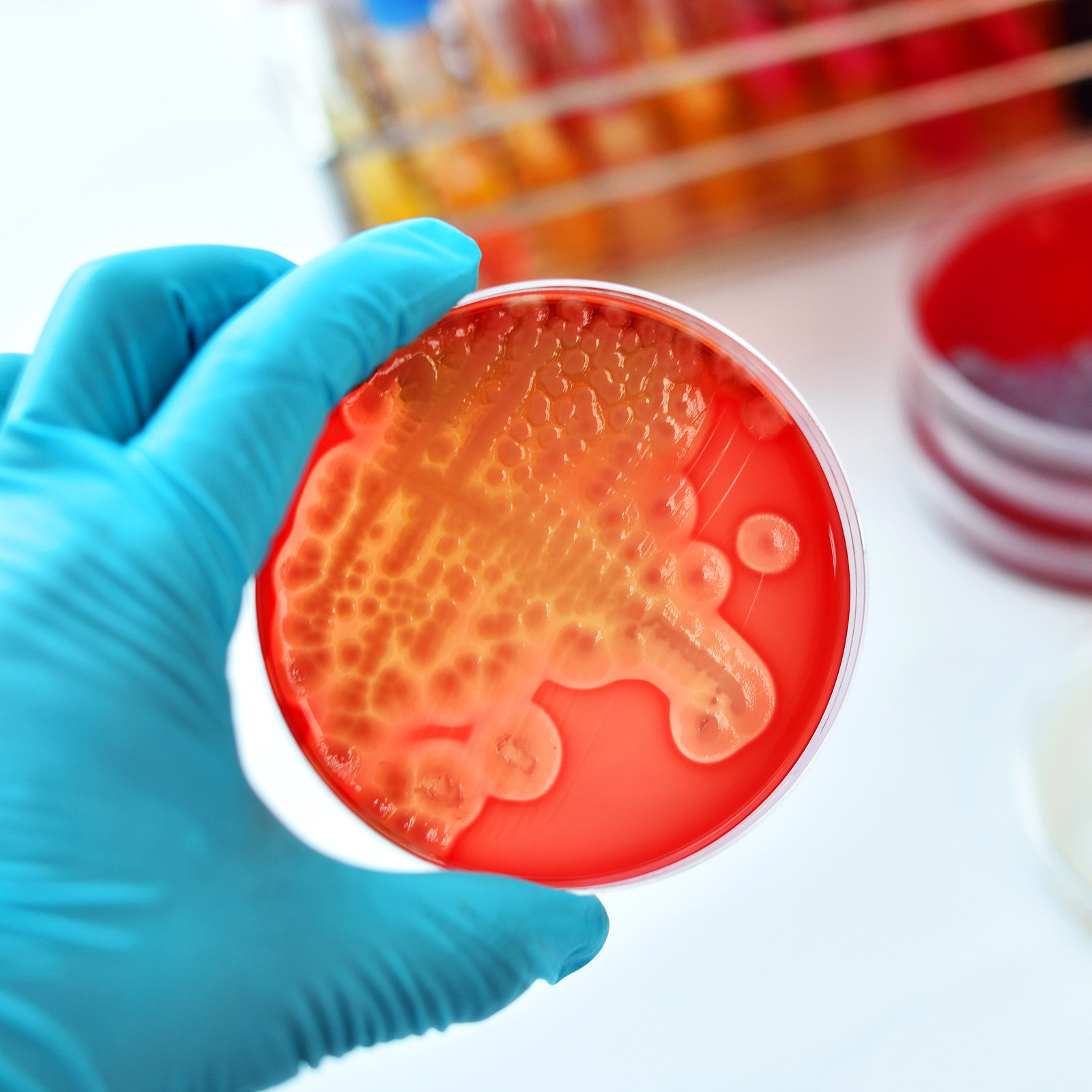 20Pcs Agar Petri Plates Pre-Po - Agar Tissue Culture のレビューと価格
