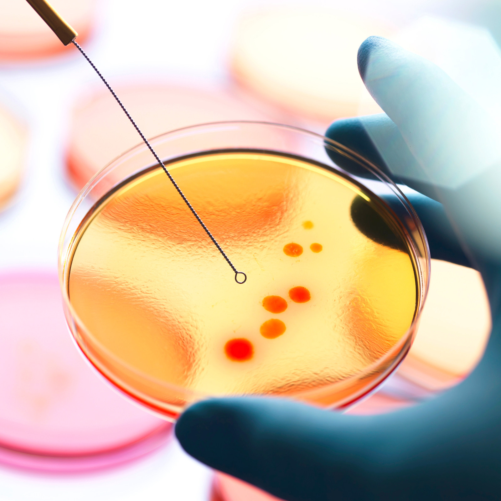 20Pcs Agar Petri Plates Pre-Po - Agar Tissue Culture のレビューと価格